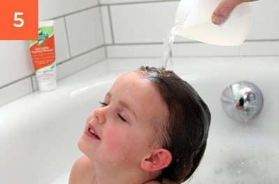 lice_steps_shots5